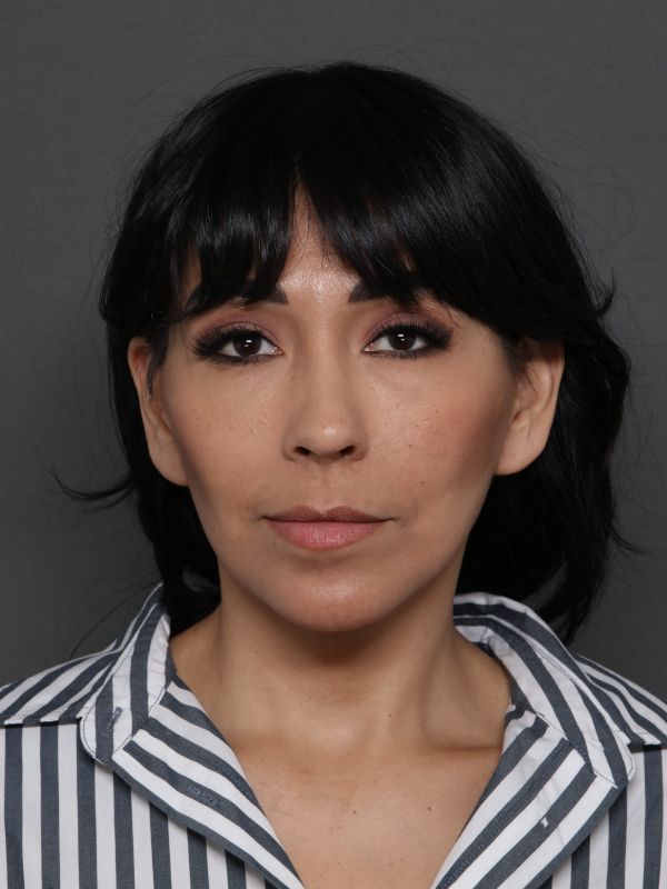 Facelift Before & After Image